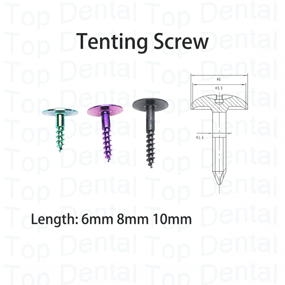 10pcs Dental GBR System Bone S - Stabilizer Screw In review and price