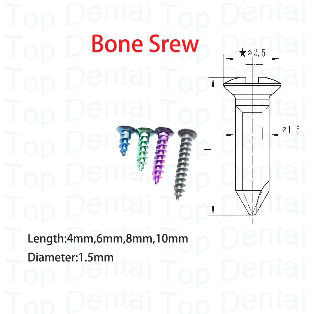 10pcs Dental GBR System Bone S - Stabilizer Screw In review and price
